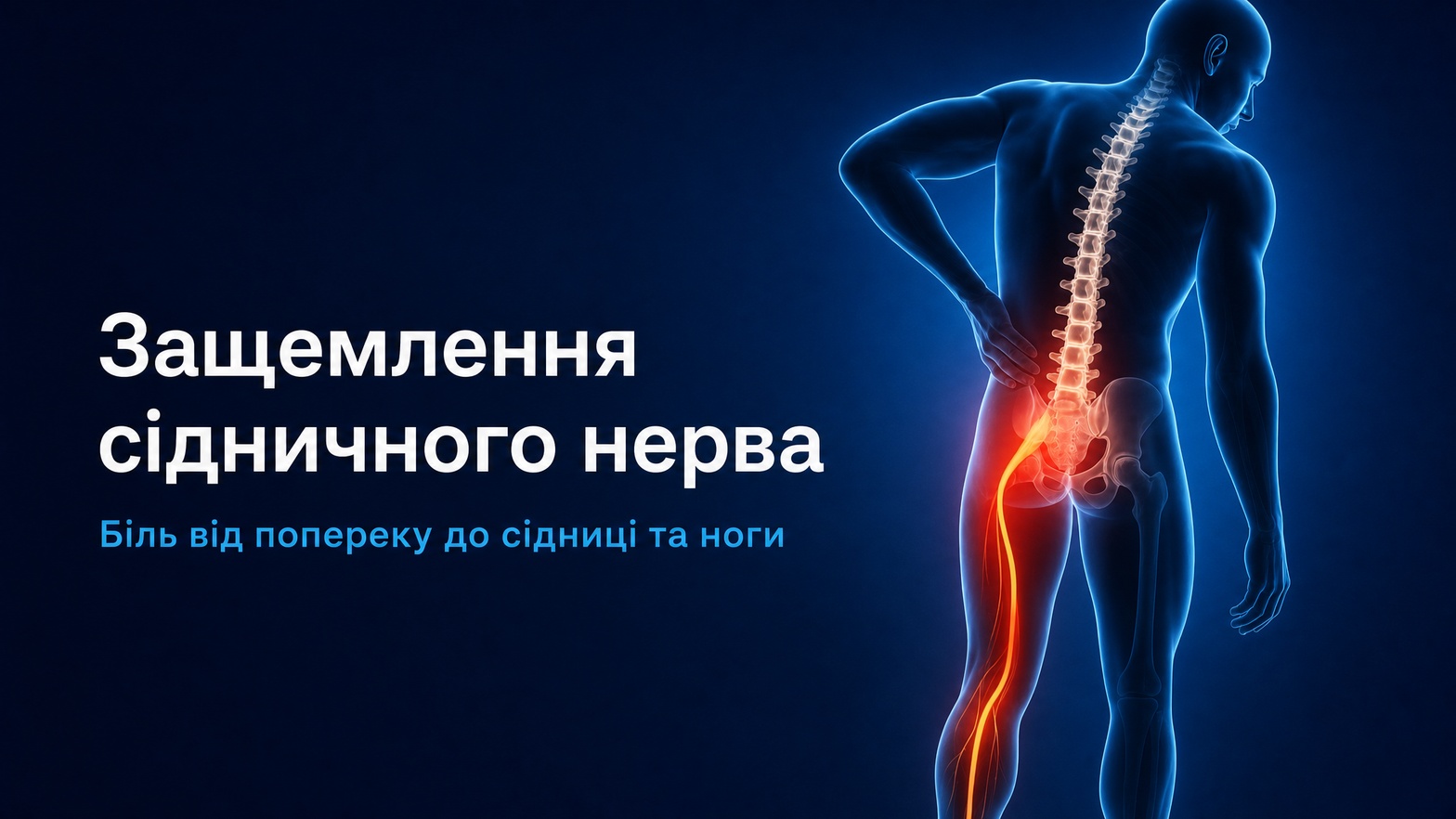 Защемлення сідничного нерва — біль від попереку до ноги